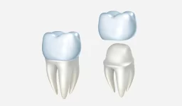 Dental Crowns: What are the types, Procedures, and Benefits?