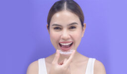 Why Should I Get Invisalign? After Invisalign, How long do you wear retainers?