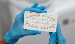 5 Benefits of Invisalign Over Traditional Braces