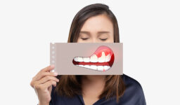 How to Strengthen Gums After Recession