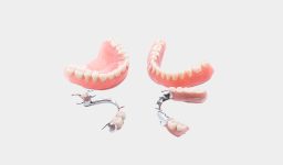Signs You Might Need Partial Dentures for Your Back Teeth