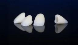 A Complete Guide to Dental Crowns: Restoring Strength and Aesthetics to Your Smile